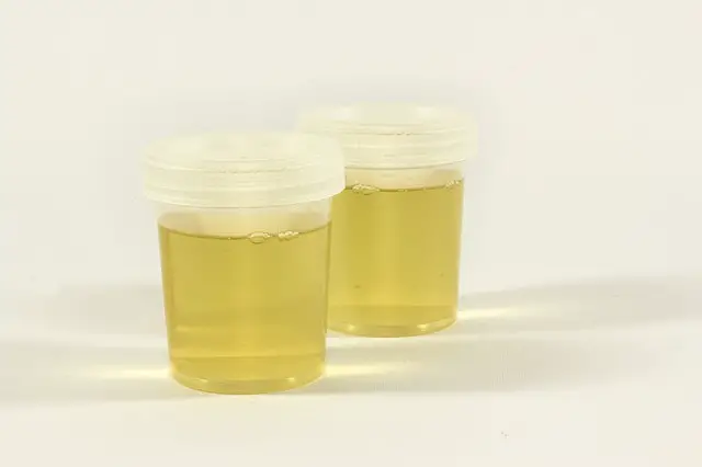 Test urine sample containers