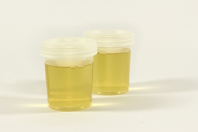 Test urine sample containers